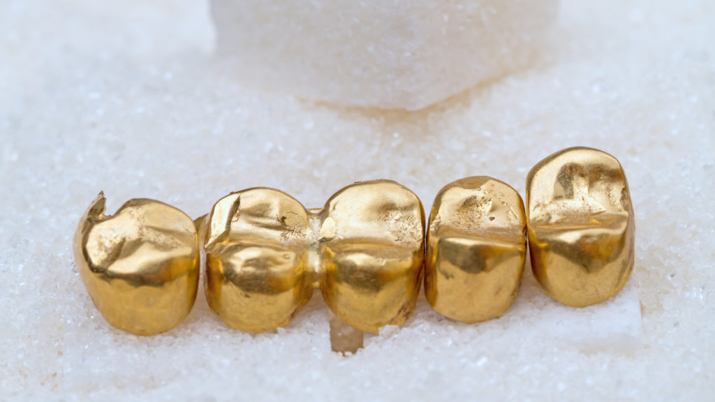 Zahngold-Ankauf-1024x576.jpg